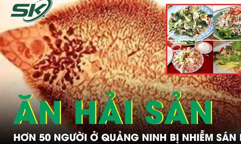 Hơn 50 người ở Quảng Ninh bị nhiễm s&#225;n l&#225; gan nhỏ v&#236; ăn hải sản sống