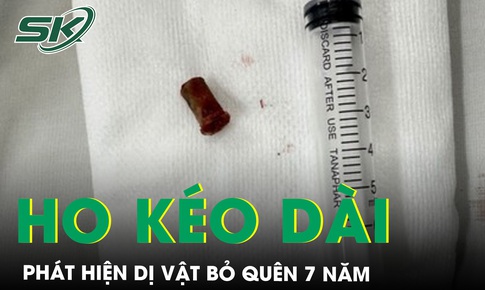 Ho k&#233;o d&#224;i, b&#224;ng ho&#224;ng ph&#225;t hiện dị vật 7 năm bỏ qu&#234;n