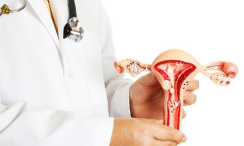 5 sự thật quan trọng về ung thư buồng trứng m&#224; phụ nữ cần biết