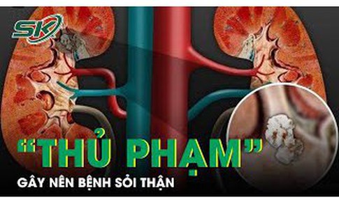 8 th&#243;i quen xấu l&#224; “thủ phạm” g&#226;y n&#234;n bệnh sỏi thận