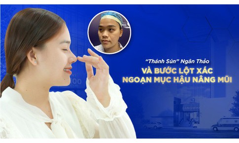 Hậu n&#226;ng mũi - Qu&#225;n qu&#226;n Th&#225;ch thức danh h&#224;i &quot;Th&#225;nh s&#250;n&quot; lột x&#225;c ngoạn mục