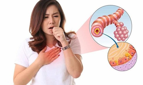Vi&#234;m phế quản mạn t&#237;nh ở người lớn