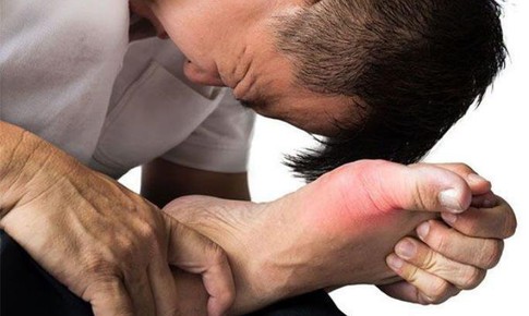 Bệnh gout mạn t&#237;nh l&#224;m g&#236; để kiểm so&#225;t  v&#224; tr&#225;nh biến chứng