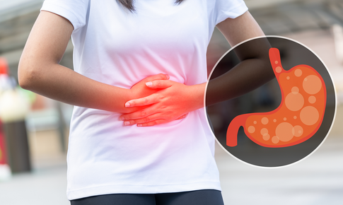 5 loại thực phẩm giúp trung hòa axit, làm giảm cơn đau dạ dày