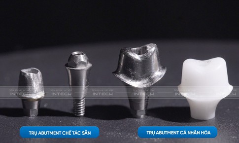 Ưu điểm vượt trội của công nghệ phục hình răng sứ trên implant DCT