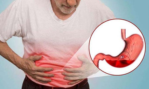 Những thói quen có hại tới dạ dày của bạn