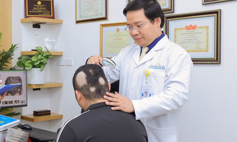 Tóc rụng thành mảng, thanh niên tự chữa mất gần 100 triệu rồi lở loét lan rộng khắp đầu