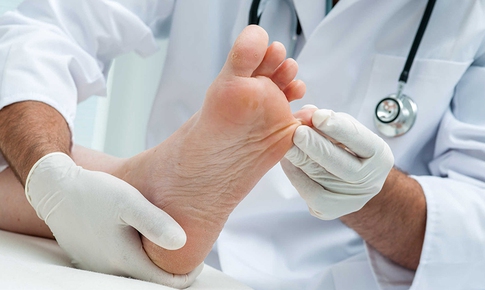 Triệu chứng và những lưu ý của bệnh tổ đỉa