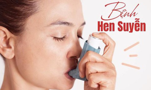 Người bệnh hen có phải kiêng đồ ăn tanh?