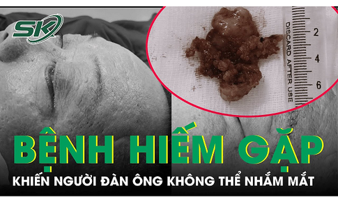 Kh&#244;ng thể nhắm mắt v&#236; căn bệnh hiếm gặp