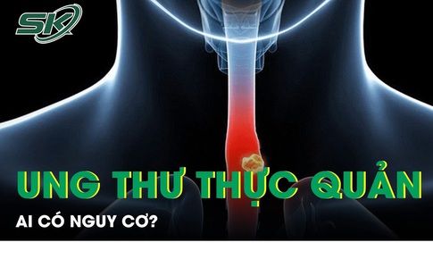 Ai c&#243; nguy cơ ung thư thực quản?