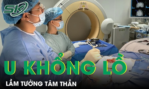 Mắc u n&#227;o lầm tưởng bị t&#226;m thần