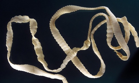 Ăn tiết canh, nem chua, nem chạo có nhiễm bệnh sán lợn gạo?