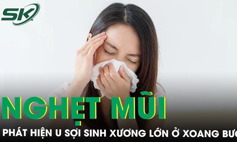 Nghẹt mũi, nhức đầu, c&#244; g&#225;i trẻ bất ngờ mắc u mũi xoang