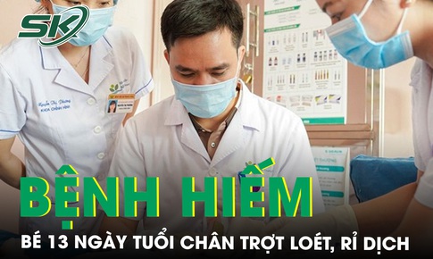Bé gái 13 ngày tuổi chân trợt loét, rỉ dịch vì bệnh hiếm gặp