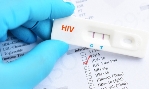 Brazil: S&#225;u người nhiễm HIV sau khi cấp gh&#233;p tạng