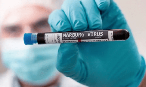 Chủ động gi&#225;m s&#225;t, ph&#225;t hiện v&#224; kiểm so&#225;t bệnh do virus Marburg