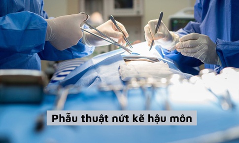 Thuốc v&#224; c&#225;c phương ph&#225;p điều trị nứt kẽ hậu m&#244;n