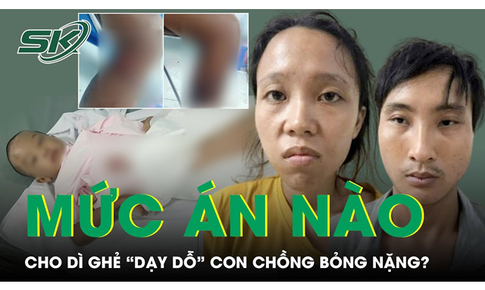 S&#225;ng 7/10: D&#236; ghẻ &#39;dạy dỗ&#39; con chồng bỏng nặng c&#243; thể đối mặt với tội danh cố &#253; g&#226;y thương t&#237;ch?