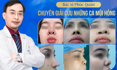 Người b&#225;c sĩ m&#225;t tay &quot;cứu tinh&quot; của những ca mũi hỏng