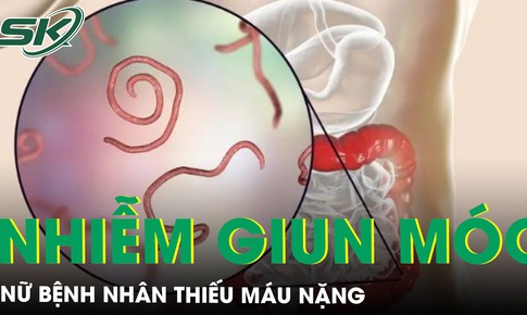 Nhiễm giun m&#243;c, người phụ nữ phải nhập viện truyền m&#225;u