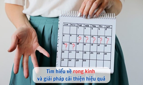 T&#236;m hiểu về rong kinh v&#224; giải ph&#225;p cải thiện hiệu quả