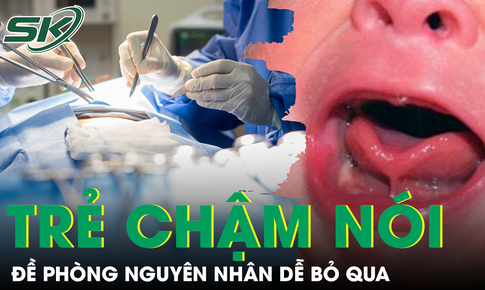 Đề ph&#242;ng nguy&#234;n nh&#226;n g&#226;y chậm n&#243;i ở trẻ nhiều phụ huynh dễ bỏ qua