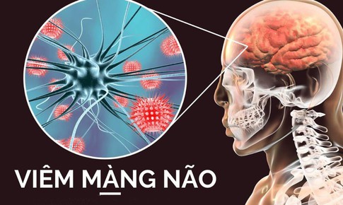 B&#224;i tập n&#224;o tốt cho người vi&#234;m n&#227;o Nhật Bản?