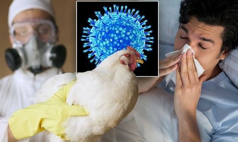 Triệu chứng nhiễm cúm A/H5N1 và các giai đoạn tiến triển của bệnh