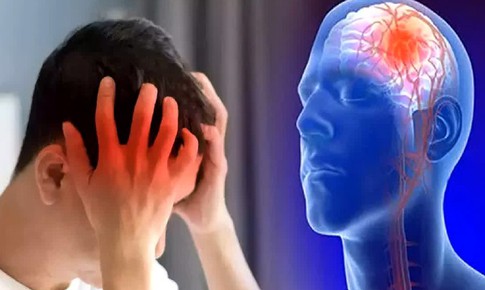 Những việc dễ l&#224;m gi&#250;p ph&#242;ng đột quỵ hiệu quả