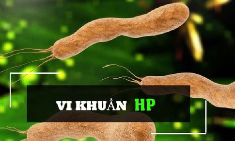 HP g&#226;y ung thư dạ d&#224;y, những điều cần biết về vi khuẩn n&#224;y