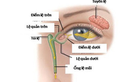 Điều trị viêm túi lệ kéo dài