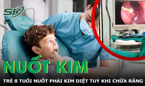 Trẻ 8 tuổi nuốt phải kim diệt tuỷ khi đi chữa răng