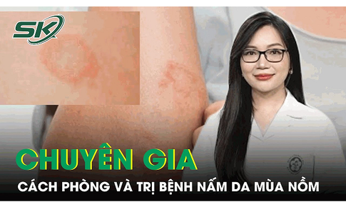 Chuy&#234;n gia chia sẻ c&#225;ch ph&#242;ng v&#224; trị bệnh nấm da m&#249;a nồm