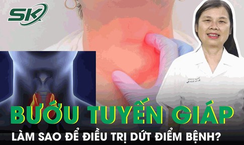 L&#224;m sao để điều trị dứt điểm bệnh bướu tuyến gi&#225;p?