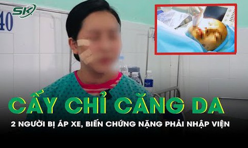 Cấy chỉ căng da, 2 người bị &#225;p xe, biến chứng nặng