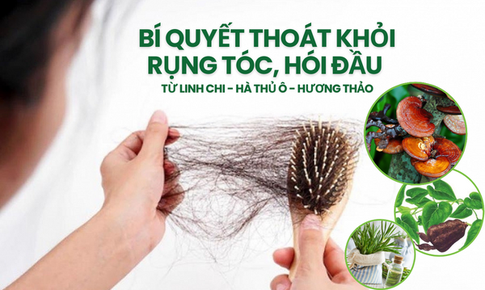 B&#237; quyết tho&#225;t khỏi rụng t&#243;c, h&#243;i đầu với bộ 3 dược liệu quen thuộc