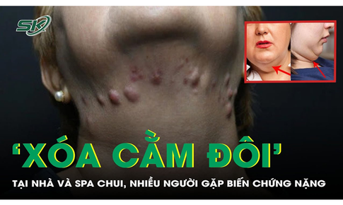 &#39;X&#243;a cằm đ&#244;i&#39; tại nh&#224; v&#224; spa chui, nhiều người gặp biến chứng nặng