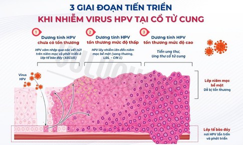 Nhiễm HPV ở cổ tử cung: c&#225;ch n&#224;o gi&#250;p cơ thể đẩy nhanh khả năng tự đ&#224;o thải HPV?