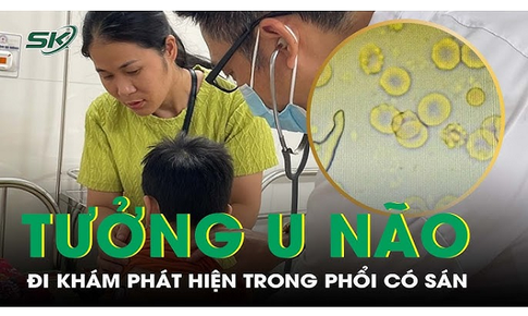 Tưởng u n&#227;o, đi kh&#225;m b&#233; trai 7 tuổi được ph&#225;t hiện trong phổi c&#243; s&#225;n