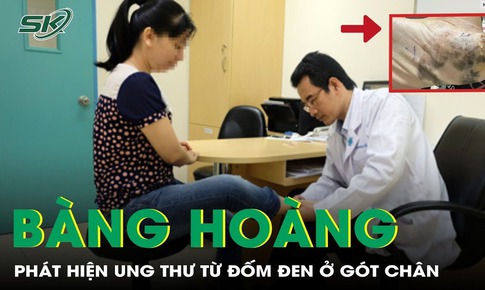 B&#224;ng ho&#224;ng ph&#225;t hiện ung thư từ đốm đen ở g&#243;t ch&#226;n