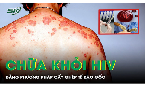 Người thứ 7 tr&#234;n thế giới được chữa HIV nhờ liệu ph&#225;p tế b&#224;o gốc