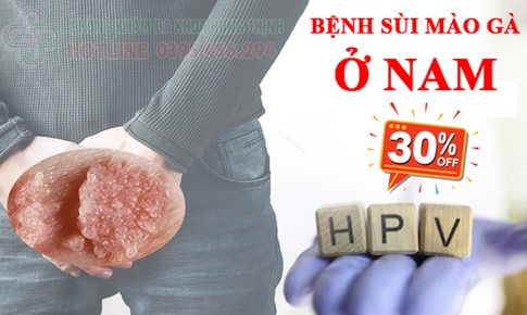 Bệnh sùi mào gà ở nam: dấu hiệu triệu chứng cách chữa
