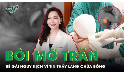 Thầy lang b&#244;i mỡ trăn chữa bỏng canh khiến b&#233; g&#225;i nguy kịch