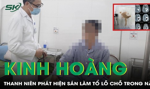 Tưởng u n&#227;o, thanh ni&#234;n đi kh&#225;m b&#224;ng ho&#224;ng ph&#225;t hiện s&#225;n l&#224;m tổ lỗ chỗ trong n&#227;o