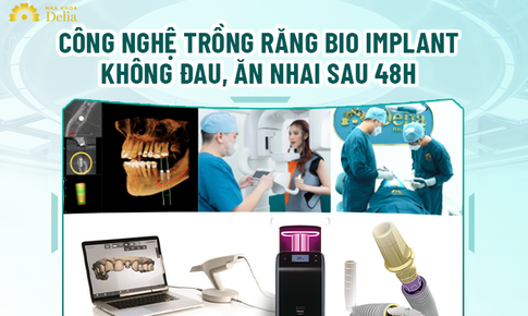 Trải nghiệm c&#244;ng nghệ trồng răng kh&#244;ng đau với nha khoa Delia