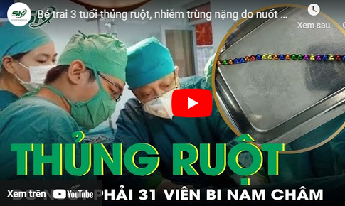 B&#233; trai 3 tuổi thủng ruột, nhiễm tr&#249;ng nặng do nuốt 31 vi&#234;n bi