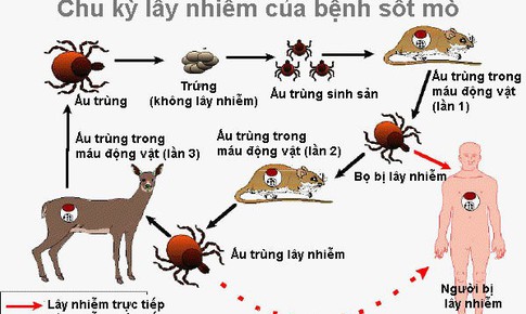 Thuốc n&#224;o điều trị sốt m&#242;?