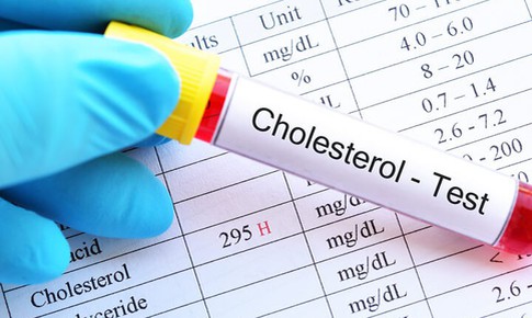 4 cách kiểm soát cholesterol máu để phòng ngừa bệnh tim mạch