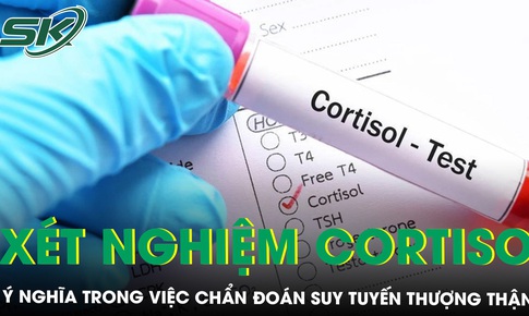 X&#233;t nghiệm cortisol c&#243; &#253; nghĩa g&#236; trong chẩn đo&#225;n suy tuyến thượng thận?